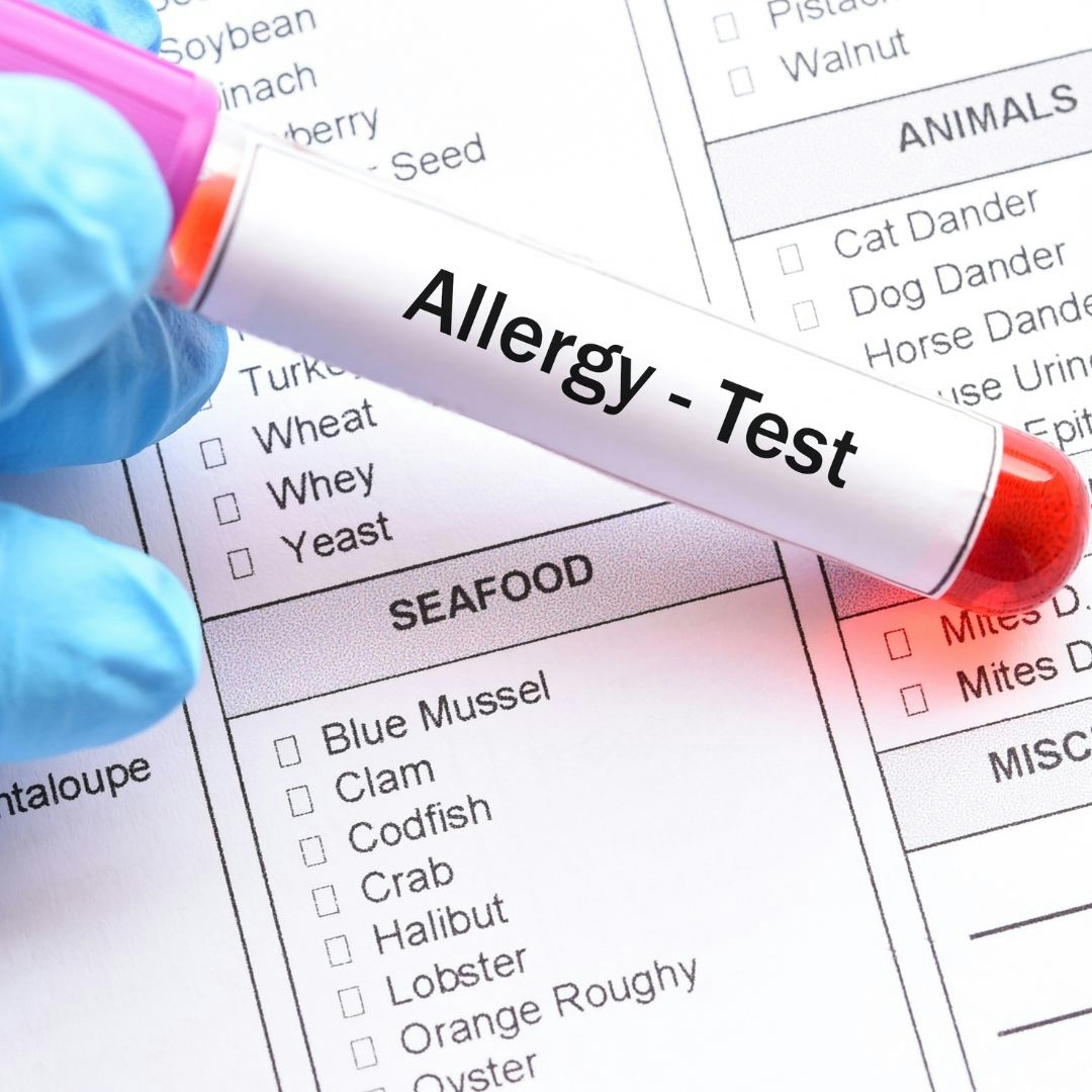 88 Panel Food and Respiratory Allergy Tests with Free Consultation, photo by Uptodate Medicare Centre